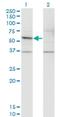 Gasdermin E antibody, H00001687-M01, Novus Biologicals, Western Blot image 