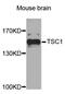 TSC Complex Subunit 1 antibody, MBS125037, MyBioSource, Western Blot image 