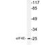 Eukaryotic Translation Initiation Factor 4E antibody, LS-C178169, Lifespan Biosciences, Western Blot image 