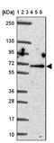 Monoamine Oxidase A antibody, NBP2-38868, Novus Biologicals, Western Blot image 