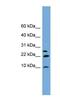 Neuronatin antibody, NBP1-57015, Novus Biologicals, Western Blot image 