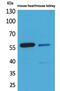 Angiopoietin 2 antibody, PA5-51083, Invitrogen Antibodies, Western Blot image 