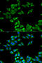 Charged Multivesicular Body Protein 2B antibody, A01935, Boster Biological Technology, Western Blot image 