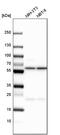 Chaperonin Containing TCP1 Subunit 6A antibody, PA5-60193, Invitrogen Antibodies, Western Blot image 