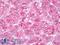 GIT ArfGAP 2 antibody, LS-B7870, Lifespan Biosciences, Immunohistochemistry paraffin image 