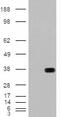 Arylsulfatase B antibody, 45-296, ProSci, Western Blot image 