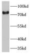 Tensin-4 antibody, FNab08848, FineTest, Western Blot image 