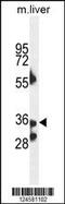 UDP-GlcNAc:BetaGal Beta-1,3-N-Acetylglucosaminyltransferase 4 antibody, 55-350, ProSci, Western Blot image 