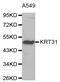 Hair keratin, type I Ha1 antibody, abx005963, Abbexa, Western Blot image 