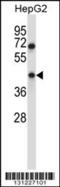 Transmembrane protein 49 antibody, 57-119, ProSci, Western Blot image 