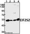 Eukaryotic Translation Initiation Factor 2 Subunit Beta antibody, A08853, Boster Biological Technology, Western Blot image 