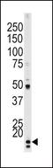 p21 antibody, PA5-12646, Invitrogen Antibodies, Western Blot image 