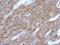 Glutathione S-Transferase Pi 1 antibody, NBP2-16756, Novus Biologicals, Immunohistochemistry paraffin image 