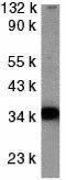 TNF Receptor Superfamily Member 10d antibody, GTX31258, GeneTex, Western Blot image 