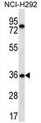 Testis Specific 13 antibody, AP54372PU-N, Origene, Western Blot image 