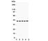 C-X-C Motif Chemokine Receptor 6 antibody, R31194, NSJ Bioreagents, Western Blot image 