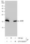 Anterior Gradient 2, Protein Disulphide Isomerase Family Member antibody, GTX130229, GeneTex, Immunoprecipitation image 