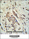 ATP Binding Cassette Subfamily C Member 11 antibody, 61-664, ProSci, Immunohistochemistry paraffin image 