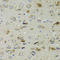 Protein Tyrosine Phosphatase Non-Receptor Type 3 antibody, LS-C334687, Lifespan Biosciences, Immunohistochemistry paraffin image 