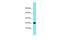 Uncharacterized protein C15orf32 antibody, PA5-46332, Invitrogen Antibodies, Western Blot image 