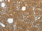 Peroxiredoxin 3 antibody, CSB-PA195573, Cusabio, Immunohistochemistry paraffin image 