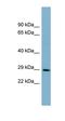 GNAS complex locus  antibody, orb330202, Biorbyt, Western Blot image 