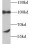 Trimethylguanosine Synthase 1 antibody, FNab08654, FineTest, Western Blot image 