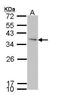 Insulin Like Growth Factor Binding Protein 3 antibody, PA5-29711, Invitrogen Antibodies, Western Blot image 