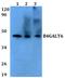 Beta-1,4-Galactosyltransferase 6 antibody, A08713, Boster Biological Technology, Western Blot image 