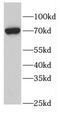 Fem-1 Homolog B antibody, FNab03073, FineTest, Western Blot image 