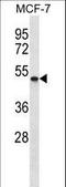 SMYD Family Member 5 antibody, LS-C156112, Lifespan Biosciences, Western Blot image 