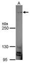 Mucin 4, Cell Surface Associated antibody, GTX100775, GeneTex, Western Blot image 