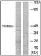Tripartite Motif Containing 59 antibody, AP32270PU-N, Origene, Western Blot image 