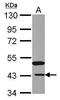N-Acetylneuraminate Synthase antibody, GTX118242, GeneTex, Western Blot image 