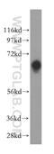 Tissue Specific Transplantation Antigen P35B antibody, 15335-1-AP, Proteintech Group, Western Blot image 