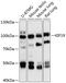 Kinesin Family Member 19 antibody, 15-241, ProSci, Western Blot image 