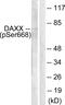 Death Domain Associated Protein antibody, PA5-38111, Invitrogen Antibodies, Western Blot image 
