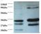 RAD23 Homolog A, Nucleotide Excision Repair Protein antibody, LS-C211067, Lifespan Biosciences, Western Blot image 
