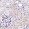 Insulin Like Growth Factor Binding Protein 1 antibody, NBP2-33475, Novus Biologicals, Immunohistochemistry paraffin image 