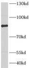 AFG3 Like Matrix AAA Peptidase Subunit 2 antibody, FNab00198, FineTest, Western Blot image 