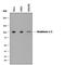 Hexokinase 1 antibody, AF8178, R&D Systems, Western Blot image 