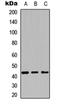 Cathepsin L antibody, orb234789, Biorbyt, Western Blot image 