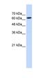 Poly(A) Binding Protein Cytoplasmic 1 Like 2B antibody, orb324845, Biorbyt, Western Blot image 