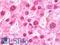 Eukaryotic Translation Initiation Factor 5A2 antibody, LS-B10870, Lifespan Biosciences, Immunohistochemistry frozen image 