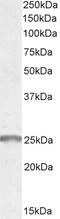 Arrestin Beta 2 antibody, 45-295, ProSci, Western Blot image 