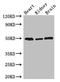 Ankyrin Repeat Domain 10 antibody, orb353883, Biorbyt, Western Blot image 
