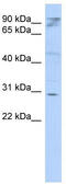 HCLS1 Associated Protein X-1 antibody, TA340094, Origene, Western Blot image 