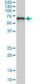 Catenin Beta Like 1 antibody, LS-C105160, Lifespan Biosciences, Western Blot image 