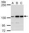 MutS Homolog 3 antibody, PA5-27864, Invitrogen Antibodies, Western Blot image 