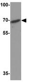 Protein Phosphatase, Mg2+/Mn2+ Dependent 1D antibody, GTX31604, GeneTex, Western Blot image 